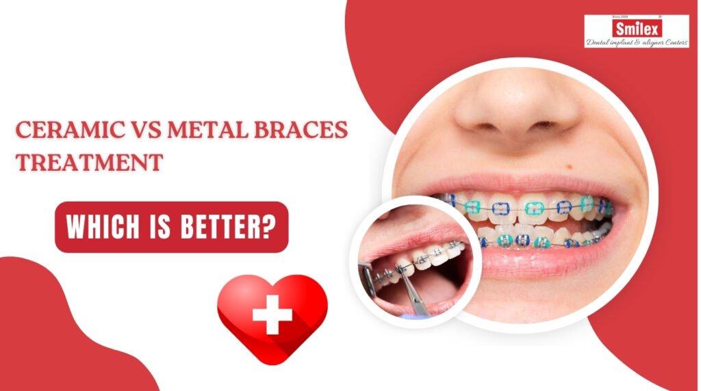 Ceramic vs Metal Braces Treatment | Which is Better? ceramic vs metal braces treatment in pune 2.jpg 1