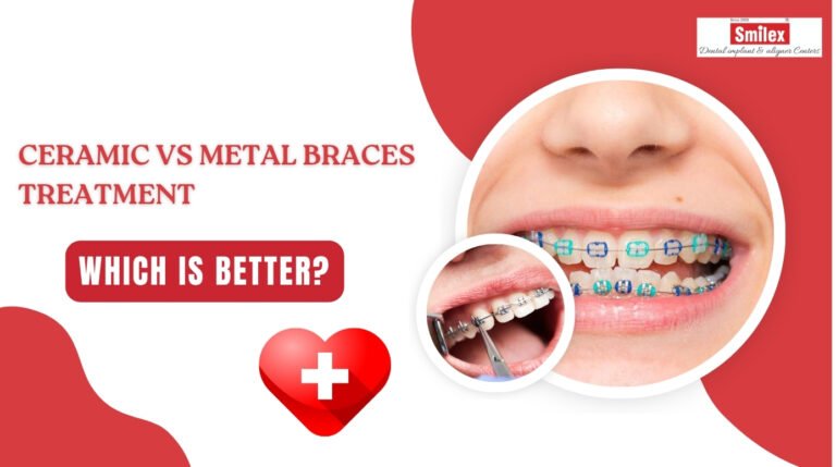 ceramic vs metal braces treatment in pune 2.jpg 1