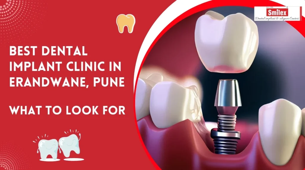 best dental implant clinic in erandwane pune what to look for.jpg