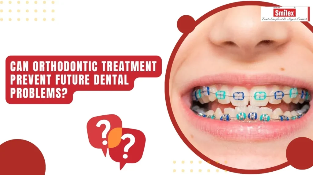 Can Orthodontic Treatment Prevent Future Dental Problems? can orthodontic treatment prevent future dental problems.jpg (1)