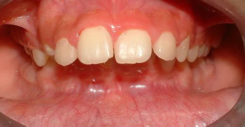 case2 before