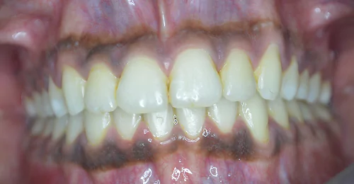 case3 before