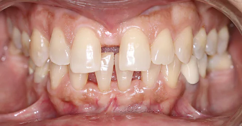 case5 before
