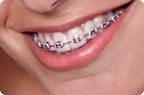 orthodontic
